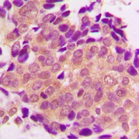 ALDOB Rabbit Polyclonal Antibody