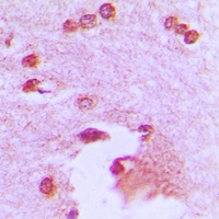 APBA2 Rabbit Polyclonal Antibody