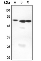 AIRE Rabbit Polyclonal Antibody