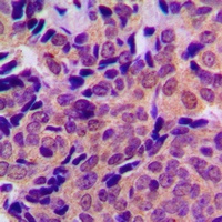 Beta Amyloid (Phospho-T743) Antibody