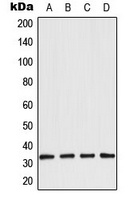 Aquaporin 3 Rabbit Polyclonal Antibody