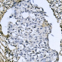 ATF4 (Phospho-S245) Antibody