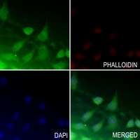 ATF4 (Phospho-S245) Antibody