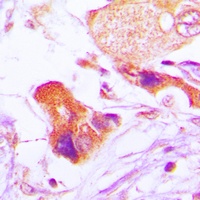BCL2 (Phospho-S70) Antibody
