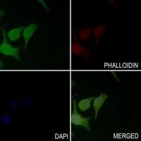 BCL2 (Phospho-S70) Antibody
