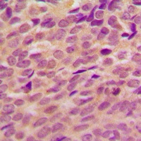 BRCA1 (Phospho-S1524) Rabbit Polyclonal Antibody