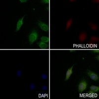 BTK (Phospho-Y223) Antibody