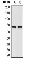 BTK (Phospho-Y551) Rabbit Polyclonal Antibody