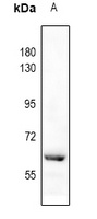 Catalase (Phospho-Y386) Antibody