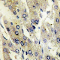 Catalase (Phospho-Y386) Antibody