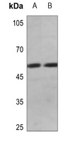 Cyclin E1 (Phospho-T395) Rabbit Polyclonal Antibody