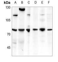 CDC25C Rabbit Polyclonal Antibody