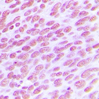 CDC25C Rabbit Polyclonal Antibody