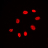 CDC25C Rabbit Polyclonal Antibody