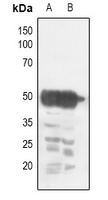 CHRNA1 Rabbit Polyclonal Antibody