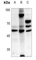CKMT2 Rabbit Polyclonal Antibody