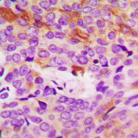 Collagen 4 alpha 5 Antibody