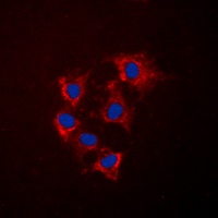 Collagen 4 alpha 5 Antibody