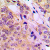 TPL2 (Phospho-T290) Antibody
