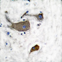 CD131 (Phospho-Y593) Antibody