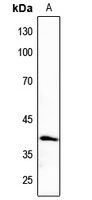 CK1 alpha Rabbit Polyclonal Antibody