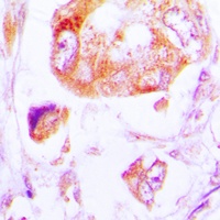 CK1 alpha Rabbit Polyclonal Antibody