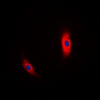 CK1 alpha Rabbit Polyclonal Antibody