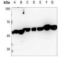 CTBP2 Rabbit Polyclonal Antibody