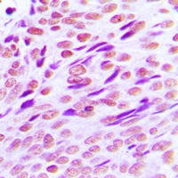 CTBP2 Rabbit Polyclonal Antibody