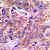 Beta-catenin (Phospho-S37) Antibody