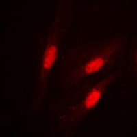 Beta-catenin (Phospho-S37) Antibody