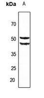 Cytochrome P450 2A6 Rabbit Polyclonal Antibody