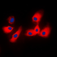 Cytochrome P450 2A6 Rabbit Polyclonal Antibody
