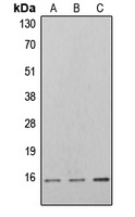 4EBP1 (Phospho-T46) Antibody