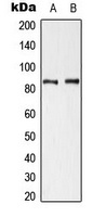 Cortactin (Phospho-Y421) Antibody