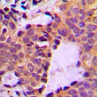 Cortactin (Phospho-Y466) Antibody
