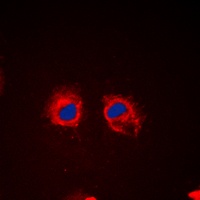 Cortactin (Phospho-Y466) Antibody
