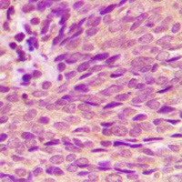 Estrogen Receptor alpha (Phospho-S118) Rabbit Polyclonal Antibody