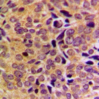 GAS8 Rabbit Polyclonal Antibody