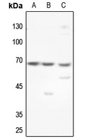 GCKR Rabbit Polyclonal Antibody