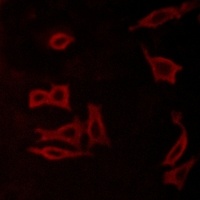 mGLUR5 Antibody