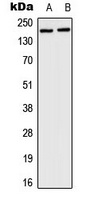 HCFC1 Rabbit Polyclonal Antibody