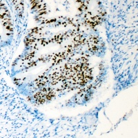 HCFC1 Rabbit Polyclonal Antibody