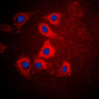 HEXB Rabbit Polyclonal Antibody