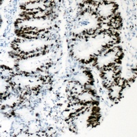 HNF4 alpha (Phospho-S313) Antibody