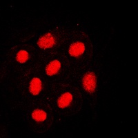 HNF4 alpha (Phospho-S313) Antibody