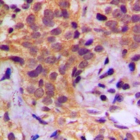 HSP90 beta (Phospho-S254) Antibody
