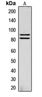 HSL (Phospho-S855) Rabbit Polyclonal Antibody