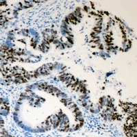 Lamin A/C (Phospho-S392) Antibody