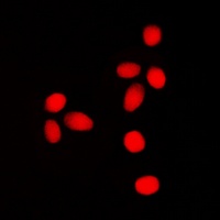 Lamin A/C (Phospho-S392) Antibody